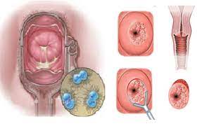 Đơn thuốc hỗ trợ viêm đường tiết niệu khi mang thai theo chỉ định bác sĩ